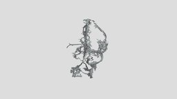 Anterior Cerebral Artery Aneurysm brain, aneurysm, neuroanatomy, neurosurgery, angioct