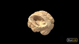 Brain anatomy, brain, university-of-michigan, human, bluelink