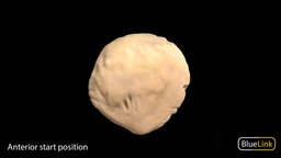 Patella anatomy, patella, bone, university-of-michigan