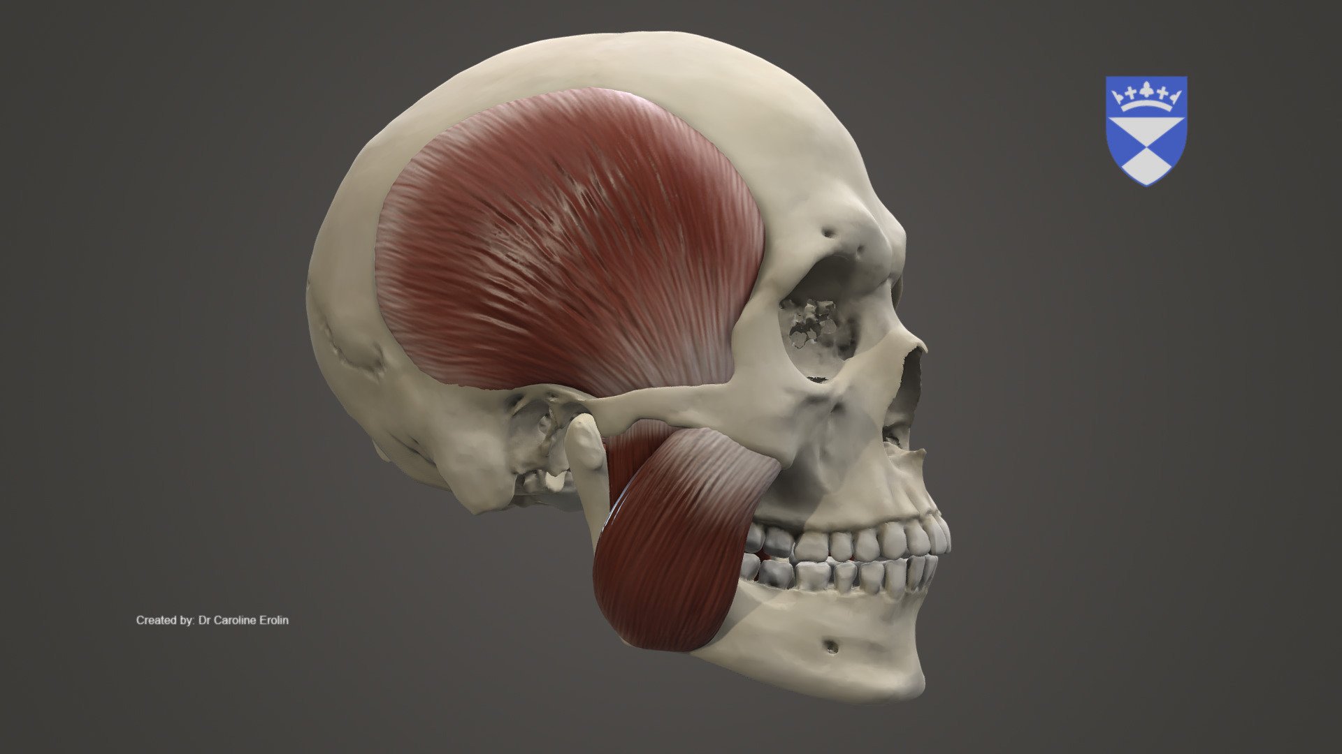 Model demonstrating the muscles of mastication. 

The skull is based on a microCT scan by the author while the muscles were sculpted in Zbrsuh. Texture added in Zbrush.