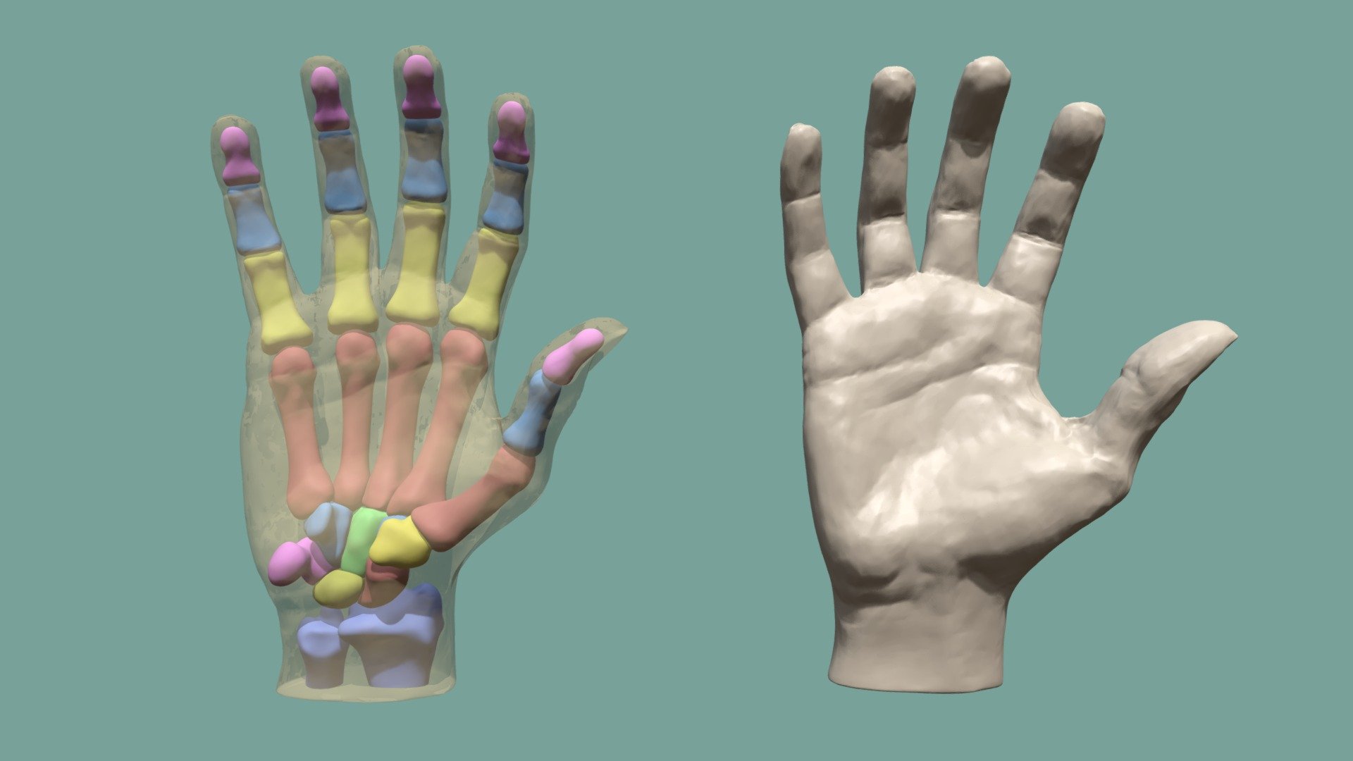 This hand sculpt is shown along side the bones of the hand to help you get an understanding of the main forms of the hand and understand how the bones contribute to the hand's over all shape.

To get the most from this turntable Find a view that you are intrested in and let the animation play or scrub through it yourself  to rotate the hands and compare the structures.

The bones of the fingers are colour coded by type:




pink - distal phalanges

blue - middle phlanges

yellow - proximal phlanges

red - metacarpals

The carpals are coloured  randomly so as they can be differentiated, with the ulna and radius in blue below them. 

I made this sculpt as part of a tutorial I am doing on the anatomy of th hand, once it is done I will be posting  it up on my website.