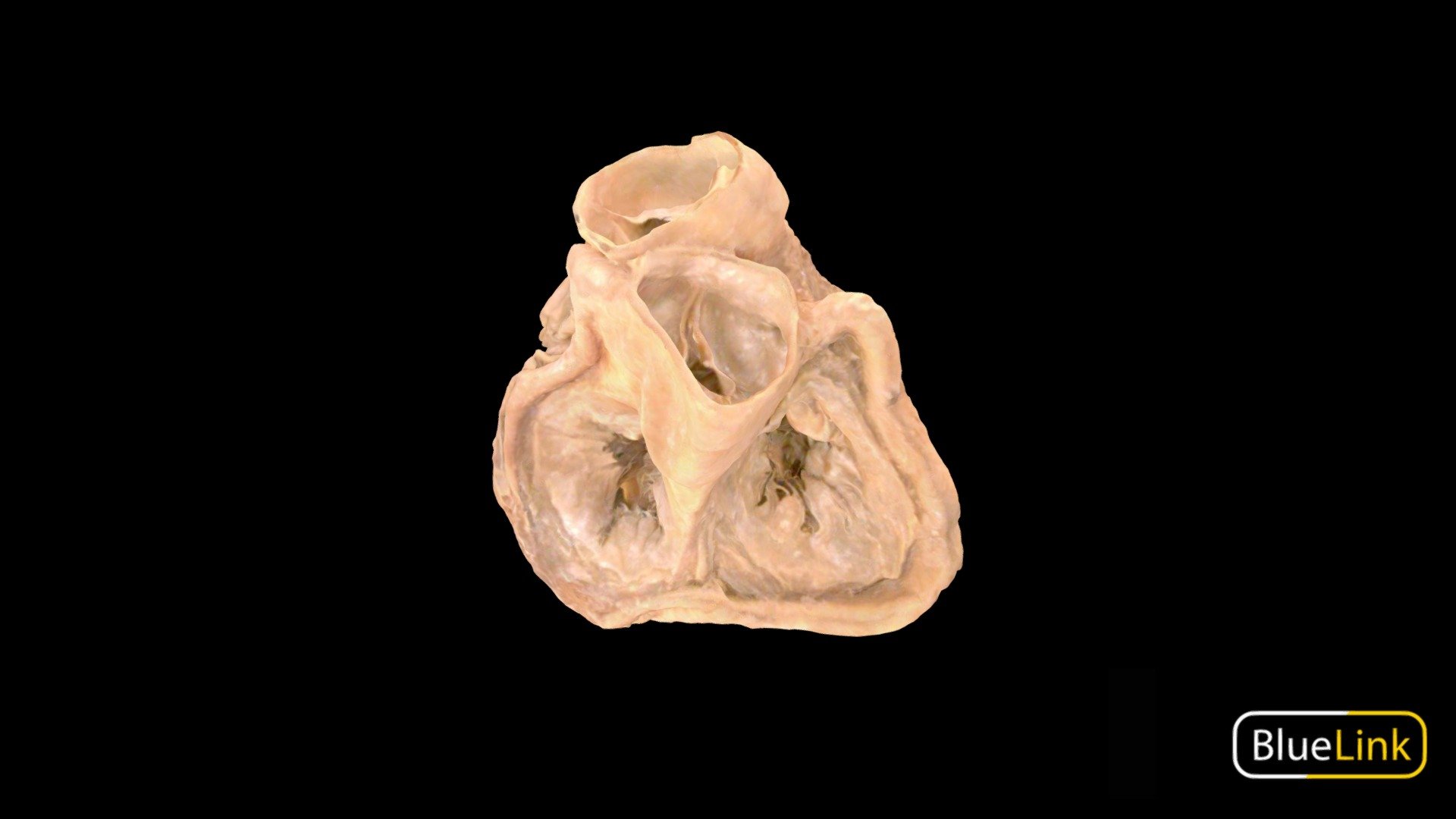 Human heart with atria removed to show heart valves
Captured with: Einscan Pro
Captured by: Will Gribbin
Edited by: Cristina Prall
University of Michigan
25981-C01