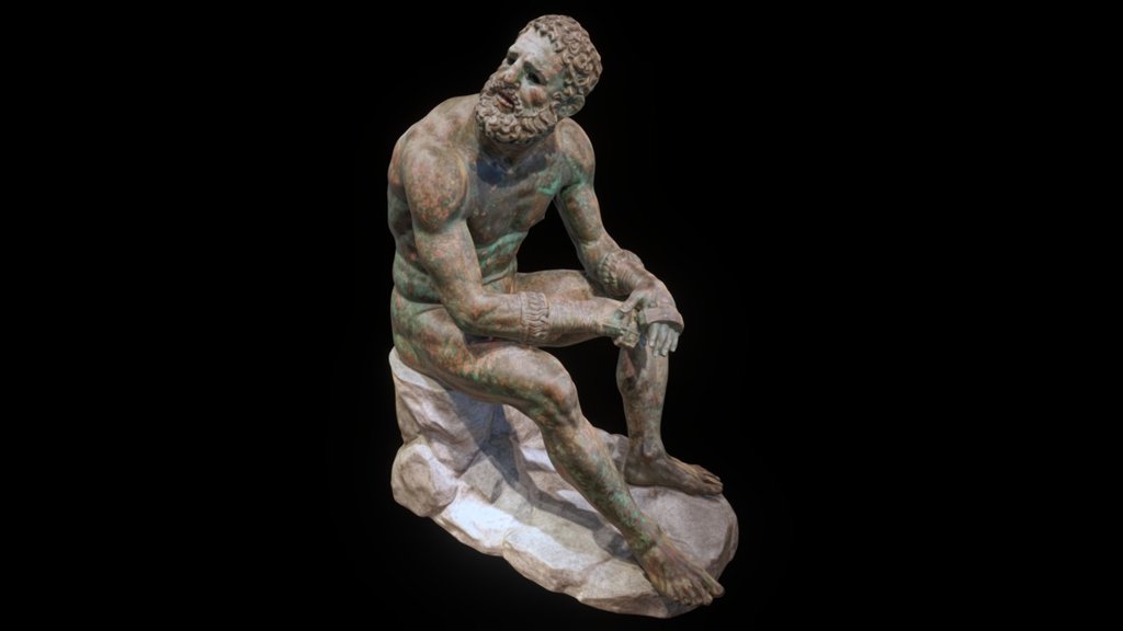 The Boxer

Bronze.

Found in Rome, on the Quirinal Hill in 1885. Now in the Palazzo Massimo alle Terme museum.

The bronze Boxer was discovered in the late 19th century, on the slopes of the Quirinal Hill in Rome, apparently after having been carefully and purposefully buried there in antiquity. 

The ancient bronze depicts a pugilist, seated and resting. His broken nose, cauliflower ears, and numerous cuts attest to time spent in the fighting ring. A few still-bleeding cuts, once picked out with inlaid copper, suggest he has just finished a fight. The rock on which he rests is not ancient.

The sculpture was created using the lost-wax casting process, and consists of eight separate peices joined together by solder.

nb: switch the texture to HD using the gear icon in the viewer to see greater detail.

This model is a more detailed and better-textured version of the original Boxer, and uses Sketchfab's PBR materials and rendering 3d model