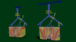 Piles hemorrhoids types anatomy, science, piles, fissures, medical, human, bleeding, rectal, hemoorhoids