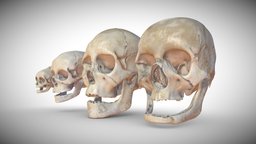 Age Based Skulls skulls, anatomy, baby, mandible, child, education, age, educational, right, anatomical, left, oldman, temporal, maxilla, inferior, lacrimal, palatine, vomer, nasal, zygomatic, newborn, ages, medical_model, ethmoid, anatomy-human, frontalis, stages, medical-illustration, skull, medical, human, sketchfab, , neonatal, conchae, setskits
