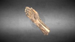 Hand anatomy/Anatomía de la mano anatomy, muscle, muscles, mano, radial, nerve, carpi, ulnaris, digitorum, pollicis, extensor, palmar, adductor, anatomia, tendon, corto, musculos, tendons, carpo, hand, ulnar, nervio, tendones, aductor, aponeurosis