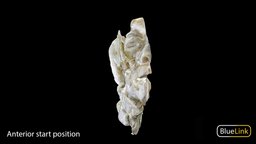 Head and Neck Hemisected Right eye, school, anatomy, college, umich, humanbody, nose, science, head, medicine, michigan, human-anatomy, throat, medical, human