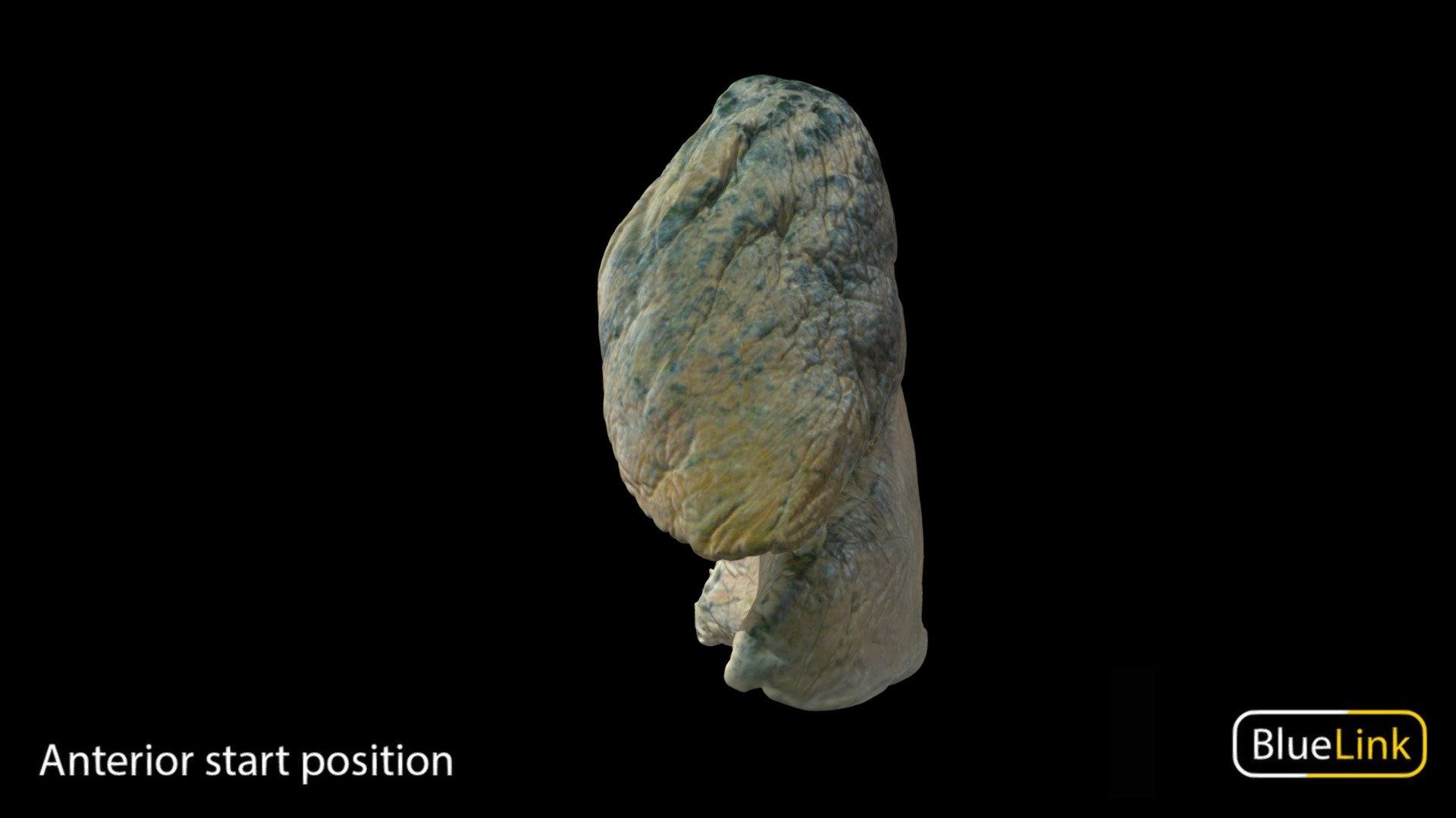 3D scan of the left lung

Captured with Einscan Pro

Captured and edited by: Madelyn Murphy

Copyright2019 BK Alsup &amp; GM Fox - Lung - Left - 3D model by Bluelink Anatomy - University of Michigan (@bluelinkanatomy) 3d model